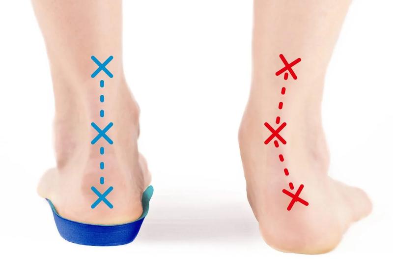 Obuwie dla dorosłych z płaskostopiem