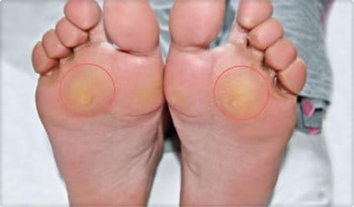 Profesjonalna ocena stóp