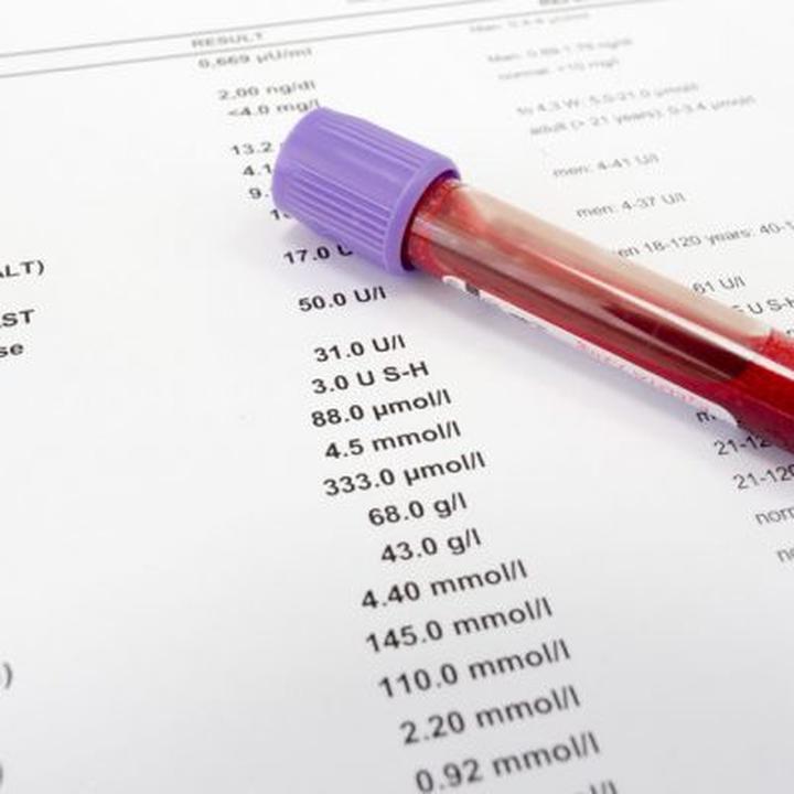 Czynniki wpływające na LH