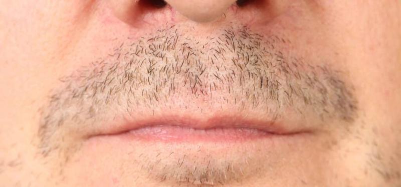 Pielęgnacja zarostu