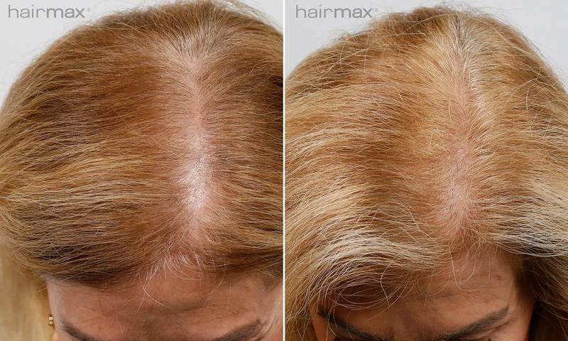 Pielęgnacja skóry podczas golenia