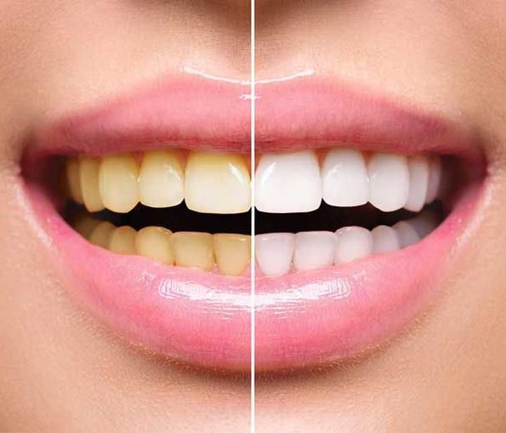 Pielęgnacja jamy ustnej